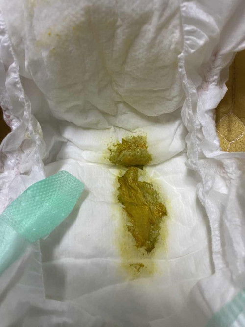 อึลูกสีนี้คืออะไรคะ