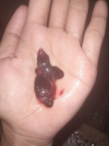 Halo bun saya mw nanya ini darah keguguran atau ?, soalnya saya telat haid 1 minggu dan keluarnyaitu