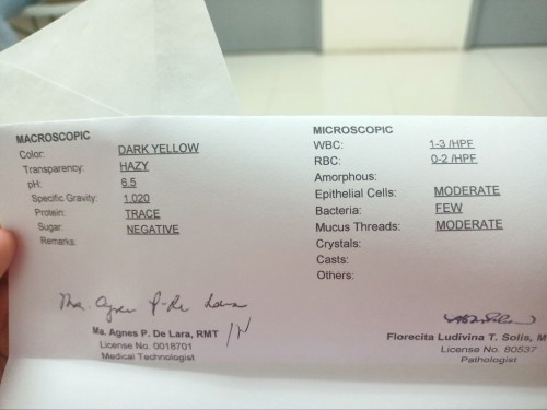 URINALYSIS RESULT