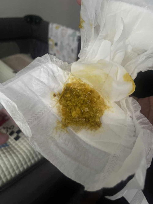 Taik bayi usia 12 hari