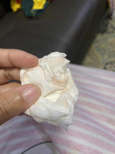 Keluar flek lendir koko