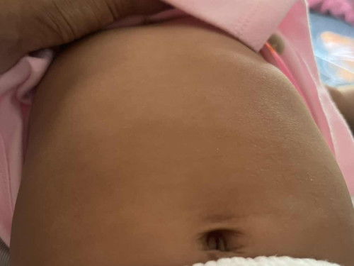 ซี่โครงเด็กแบบนี้ปกติไหม