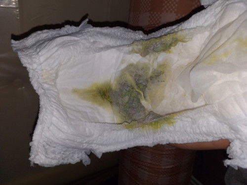 Poop atau feses anak bewarna hijau abu-abu, Full ASI