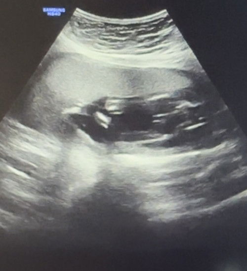 tanong ko lang po hehe