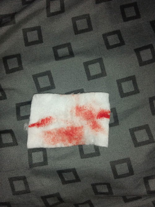 Mau tanya bun tanggapannya gimna yah kalo berdarah gini