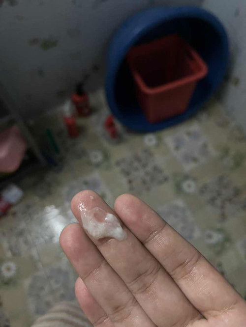 38+4วีคมีหมูกแบบนี้ต้องไปหาหมอไหมค่ะ