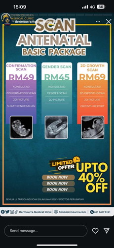 Scan mana yang terbaik