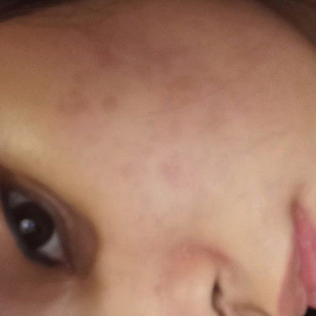 Skincare reco?