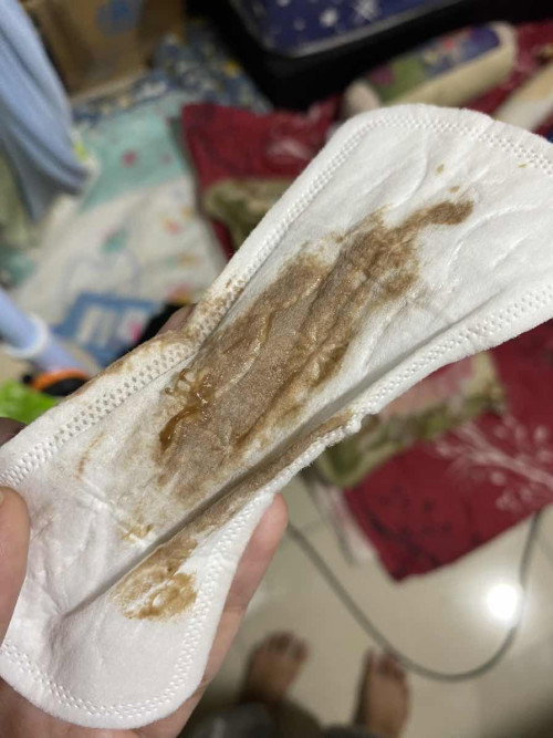 Hi boleh bantu sapa ii pernah jadi mcm nii