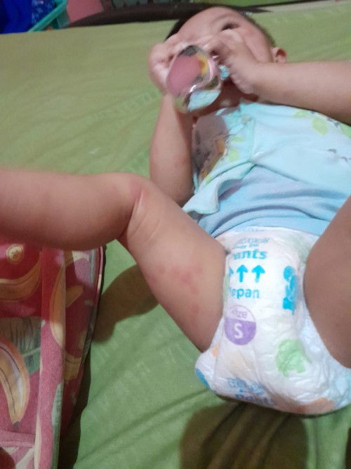 Bayi 7bln Panas selama 6 hari disertai BAB cair