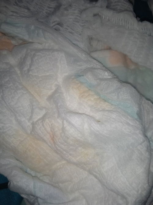 bayi 5 bulan pipis bercak orange