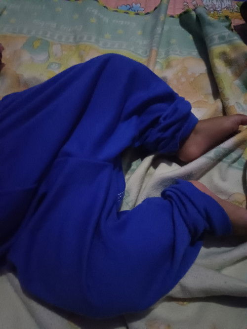 Kenapa ya Bun kaki anak saya tidak mau lurus, pasti setiap hari posisinya seperti ini, dan sekarang