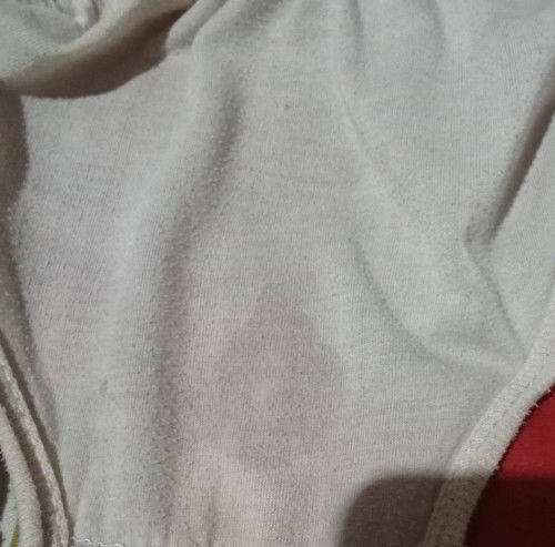 Air ketuban merembes atau bukan