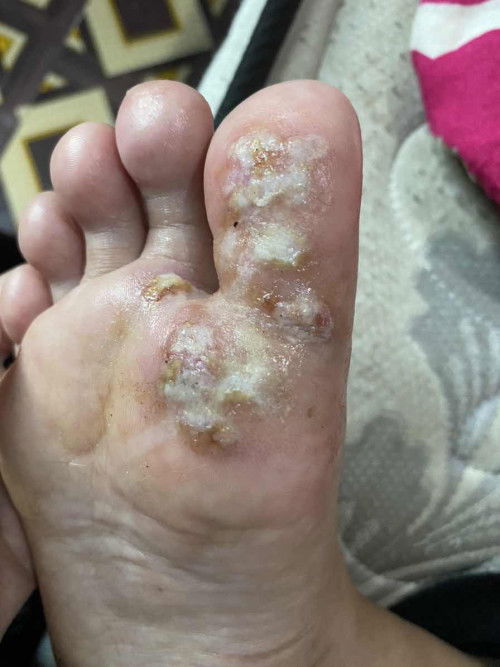 Ada yang pernah ngalamin jugak ?