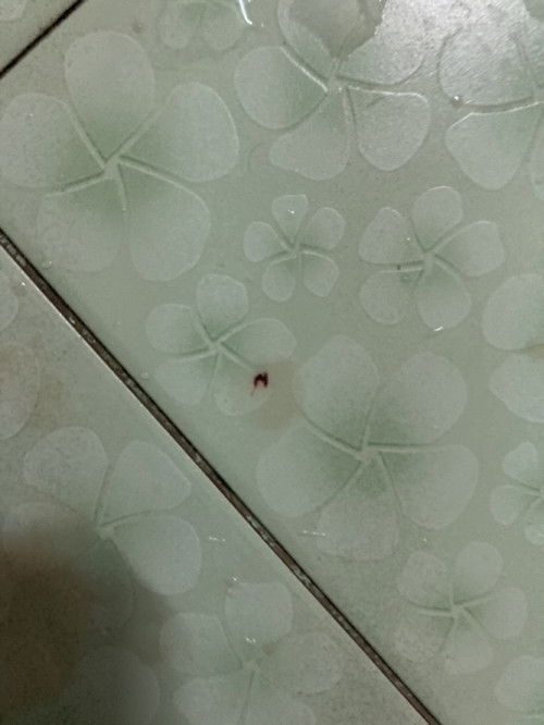 เลือดออกมาพร้อมเสมหะ