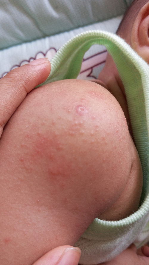 kalau anak gini kena apa ya bun?