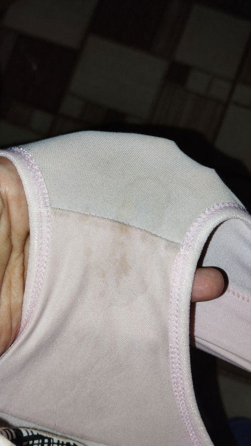 Ketuban atau keputihan