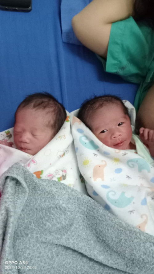 ลูกแฝดแฝดชาย