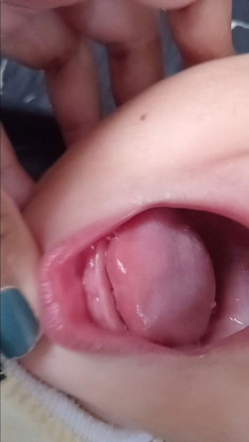 ฟันกำลังขึ้นใช่มั้ยคะ?