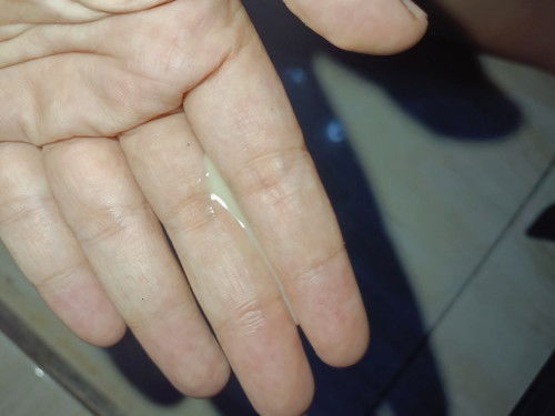 34 w selalu keluar cairan warna putih susu di  miss v