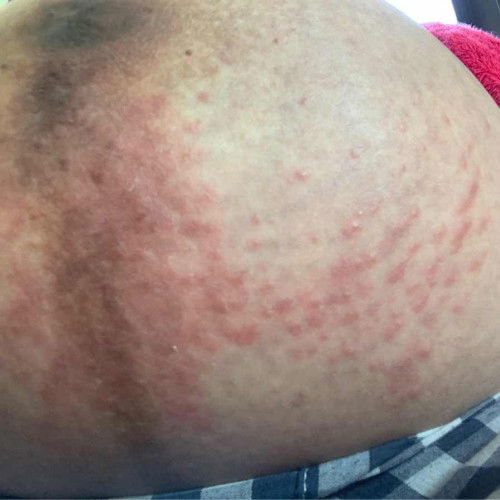 ขอคำแนะนำจากแม่ๆด้วยนะคะ