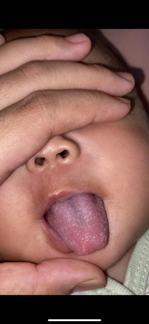 Lidah jamur apa bukan