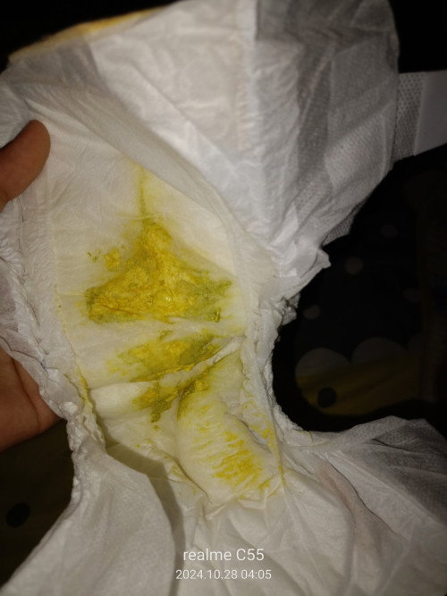 Warna pup kuning campur hijau