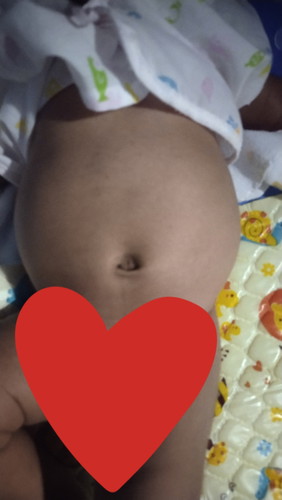 กินนมเกินกระเพาะ