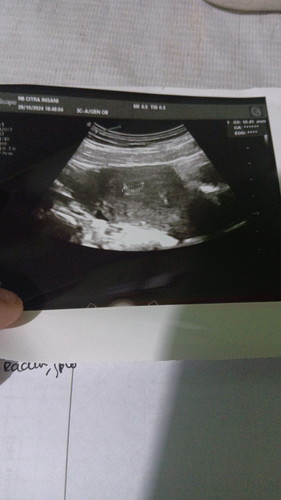 Hamil 6week
