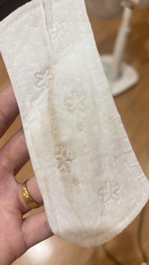 ใครเคยมีตกขาวสีน้ำตาล ท้อง 11 week บ้างคะ