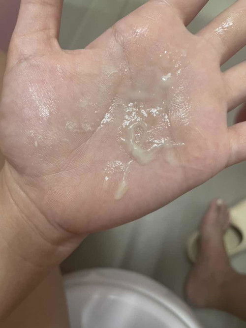 อันนี้คือใกล้ยังคะแม่ท้องได้36+6ละคะ