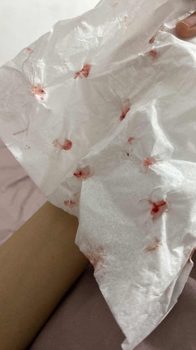 Usia kehamilan 28 week