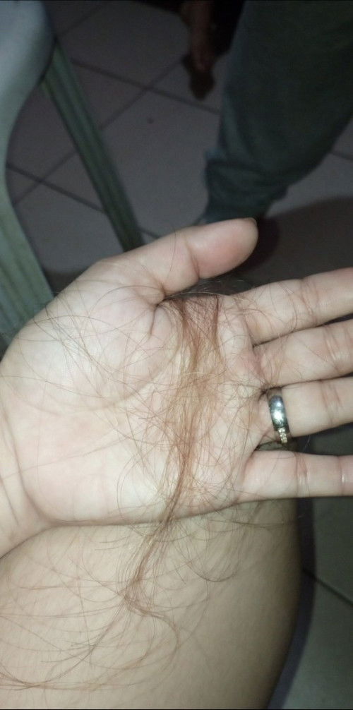 3 months napo si baby and nag start nako mag hair fall ng bongga.