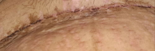 bekas sesar mengelupas