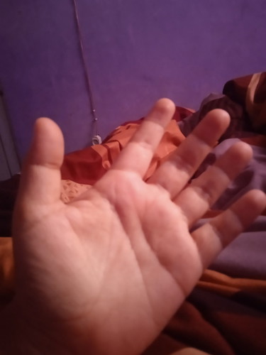 Pagii Bun,mau shering pengalaman kehamilan pertama,lagi sering ngerasain linu kebas pada jari tangan