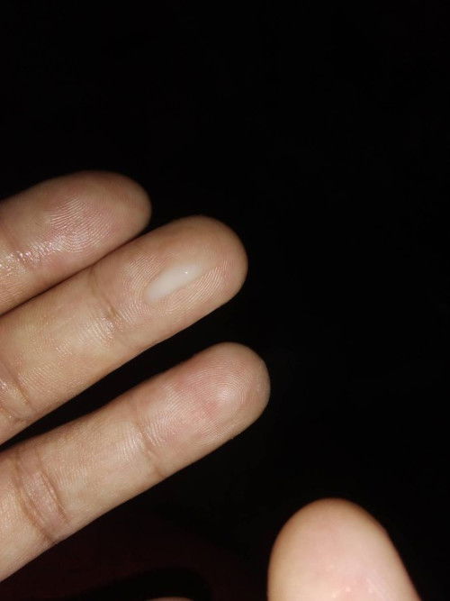 ช่วยดูหน่อยค่ะแม่ๆ 37+4