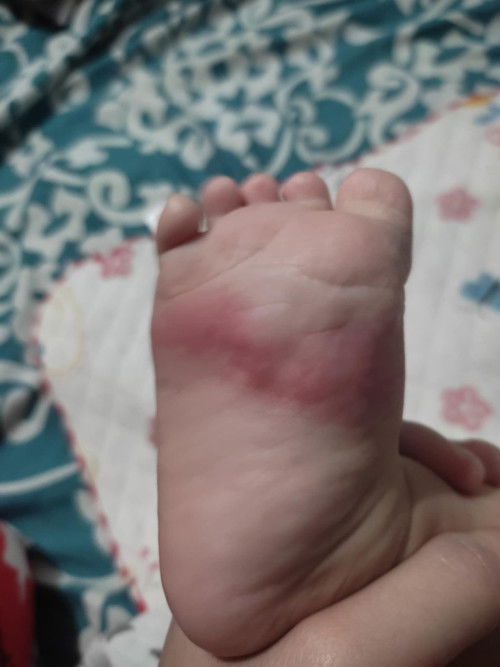 Red line foot sa baby