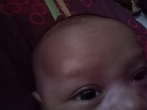 Kira² ini knpa ya..kok ada tanda putih?bisa hilang tidak?bayi usia 1 blna