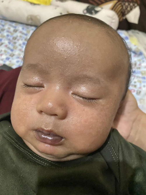 Apakah ini normal atau tidak?