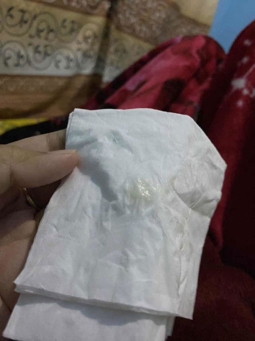 Keputihan hamil muda