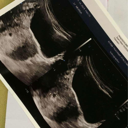 hpht 8 september dicek masih kantong