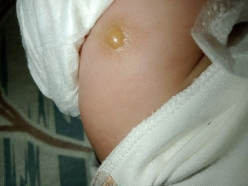 Con bị thế này là bị sao vậy ạ