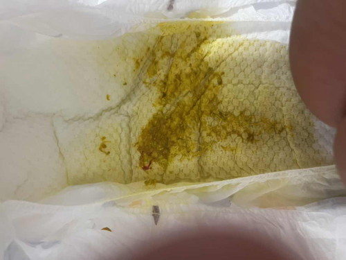 ลูกอึมีเลือด เป็นอะไรไหมคะ