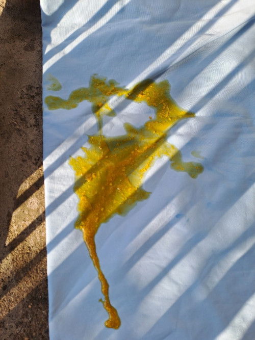 เด็กถ่ายแบบนี้ปกติไหม