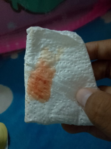 น้ำคาวปลาสีแบบนี้ปกติไหมคะ