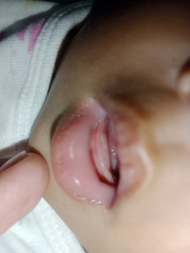 nag ngingipin na kaya si baby ko nyan. 4 months 10days pa lang po sya