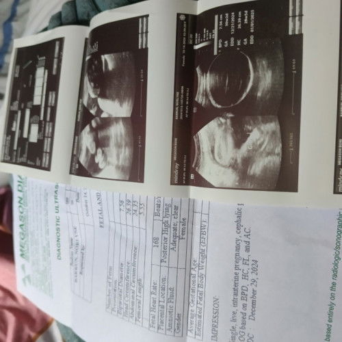 Normal po ba na sumasakit Ang ipin pag nag buntis