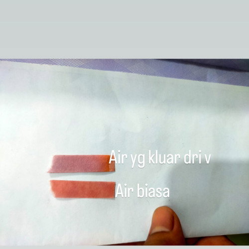Rembes air ketuban