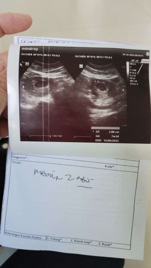 hasil USG tadi 7week3d masih keliatan kantong disuruh balik lagi 2 minggu kemudian ada yg sama bun