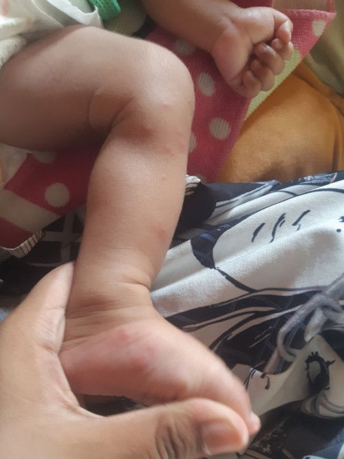 แบบนี้คือยุงกีดหรืออะไรหรอคะ